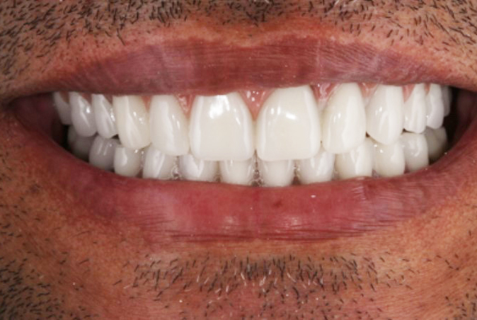 Transformação Completa - Protocolo